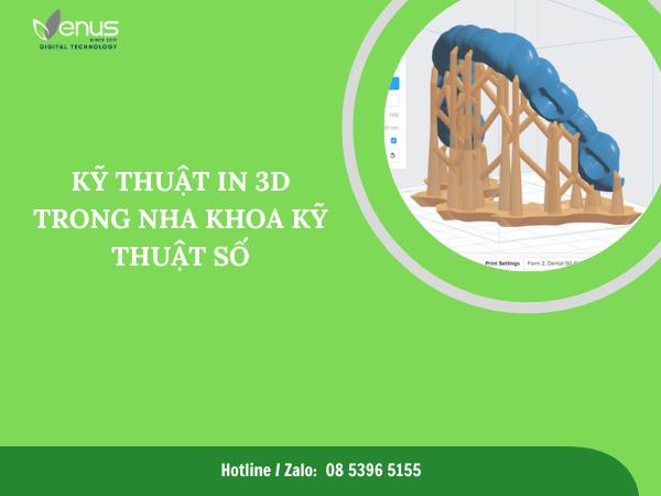 KỸ THUẬT IN 3D TRONG NHA KHOA KỸ THUẬT SỐ