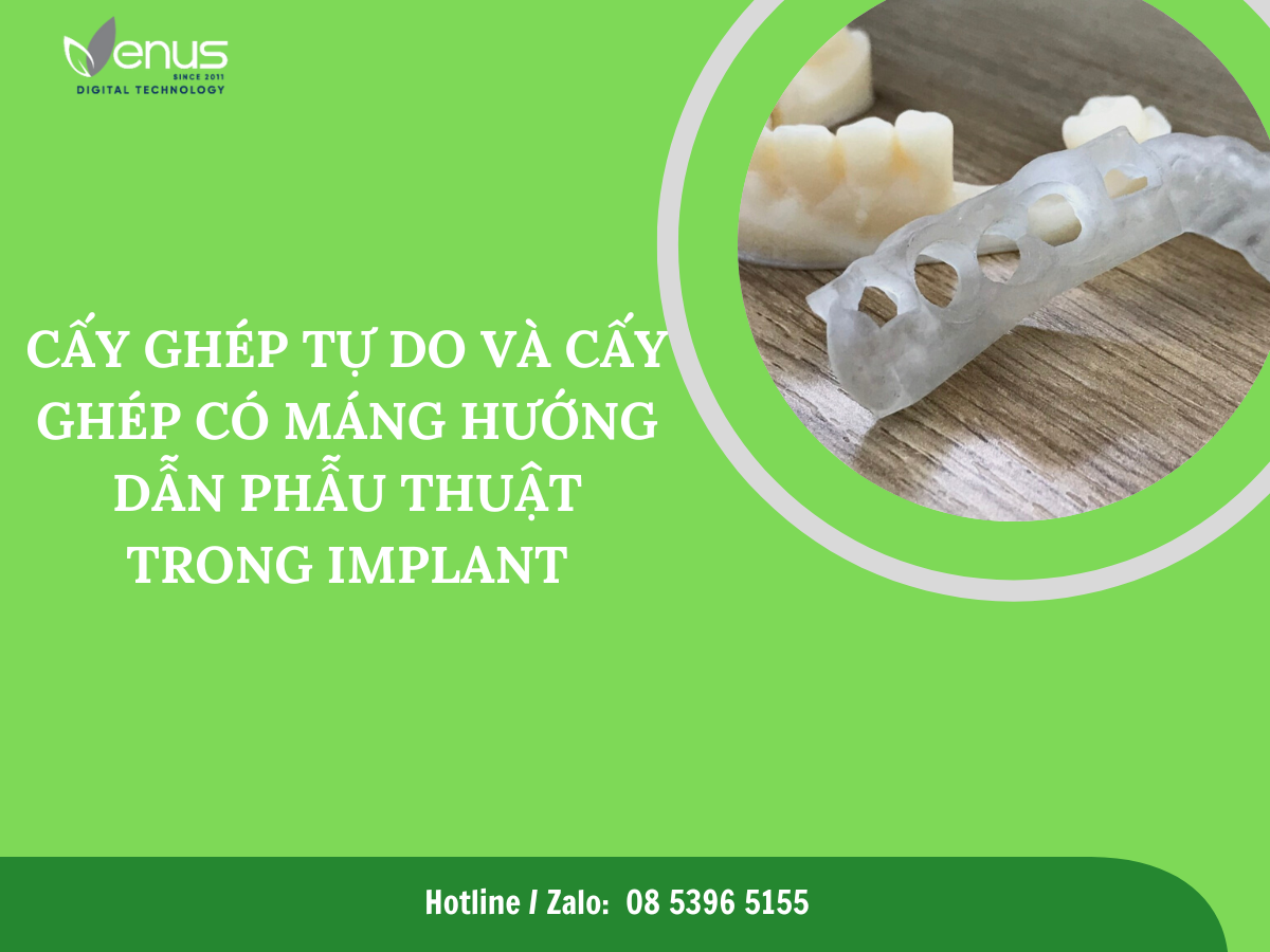 CẤY GHÉP TỰ DO VÀ CẤY GHÉP CÓ MÁNG HƯỚNG DẪN TRONG IMPLANT